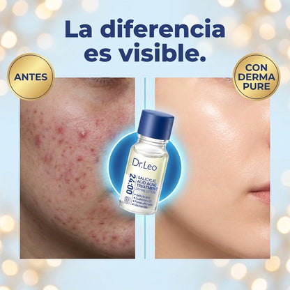 DermaPure™ - Serum Dr. Leo Anti Acné